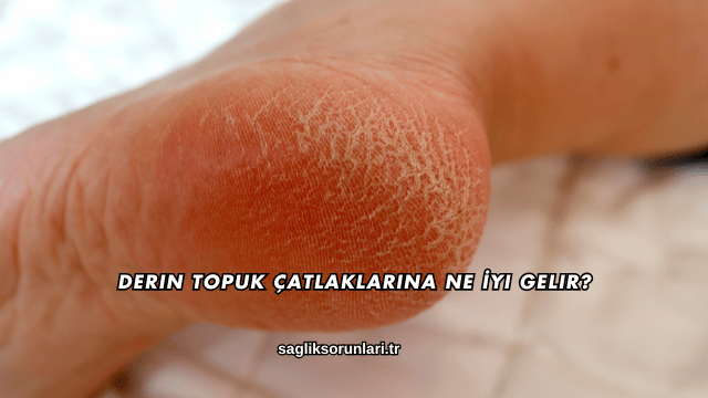 Derin Topuk Çatlaklarına Ne İyi Gelir?