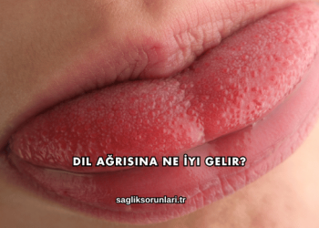 Dil Ağrısına Ne İyi Gelir?