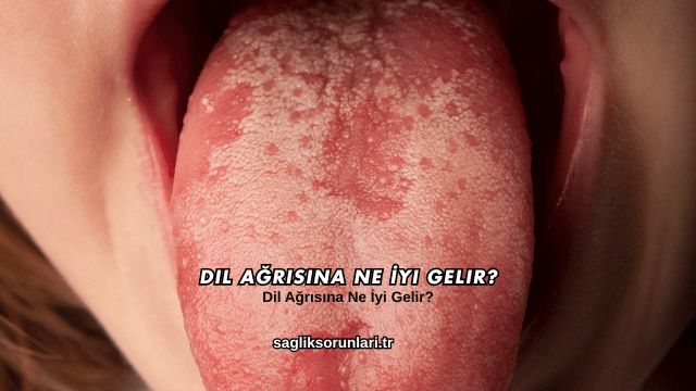 Dil Ağrısına Ne İyi Gelir?