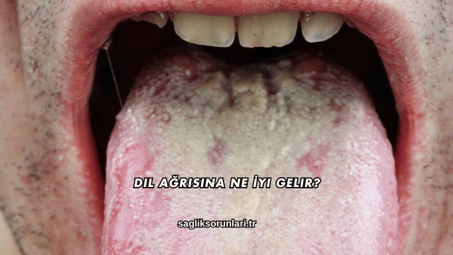 Dil Ağrısına Ne İyi Gelir?