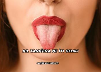 Dil Yanığına Ne İyi Gelir?