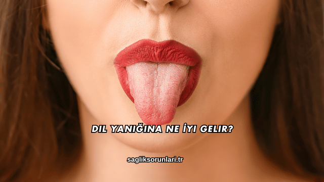 Dil Yanığına Ne İyi Gelir?