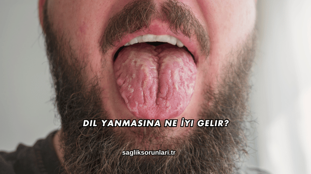 Dil Yanmasına Ne İyi Gelir?