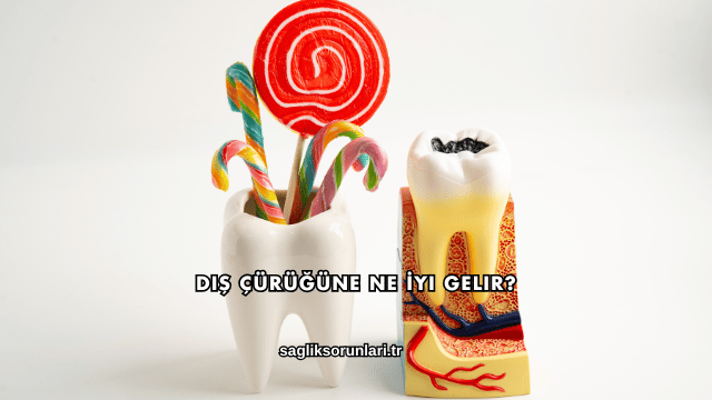 Diş Çürüğüne Ne İyi Gelir?