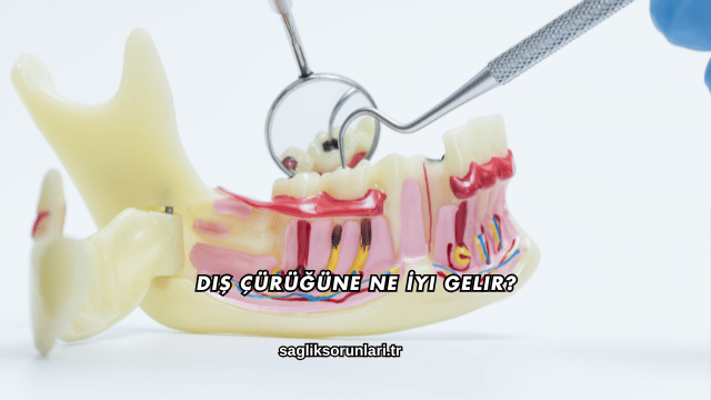 Diş Çürüğüne Ne İyi Gelir?