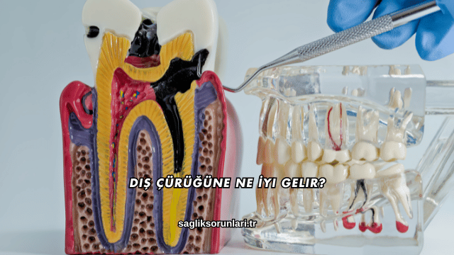 Diş Çürüğüne Ne İyi Gelir?