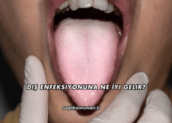 Diş Enfeksiyonuna Ne İyi Gelir?