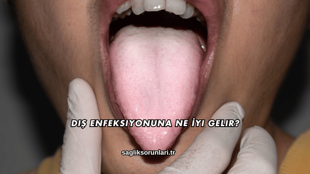 Diş Enfeksiyonuna Ne İyi Gelir?