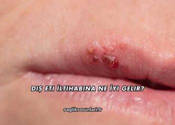 Diş Eti İltihabına Ne İyi Gelir?