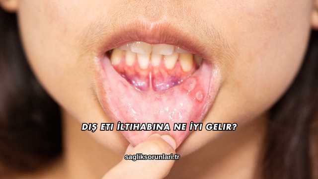 Diş Eti İltihabına Ne İyi Gelir?