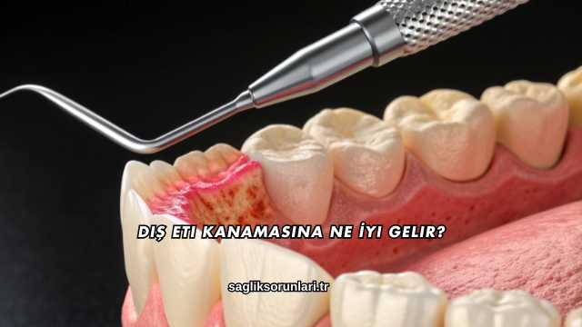 Diş Eti Kanamasına Ne İyi Gelir?