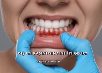 Diş Eti Kaşıntısına Ne İyi Gelir?