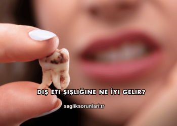 Diş Eti Şişliğine Ne İyi Gelir?