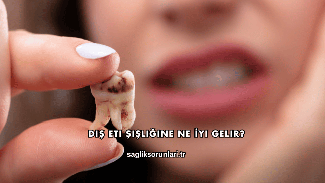 Diş Eti Şişliğine Ne İyi Gelir?