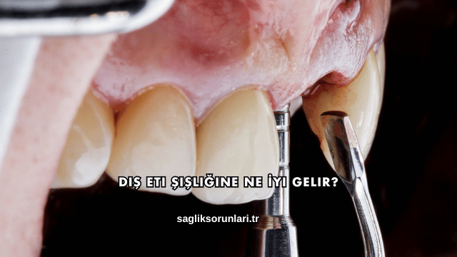 Diş Eti Şişliğine Ne İyi Gelir?