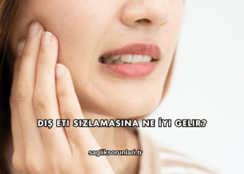 Diş Eti Sızlamasına Ne İyi Gelir?