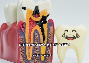 Diş İltihabına Ne İyi Gelir?