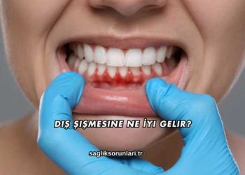Diş Şişmesine Ne İyi Gelir?