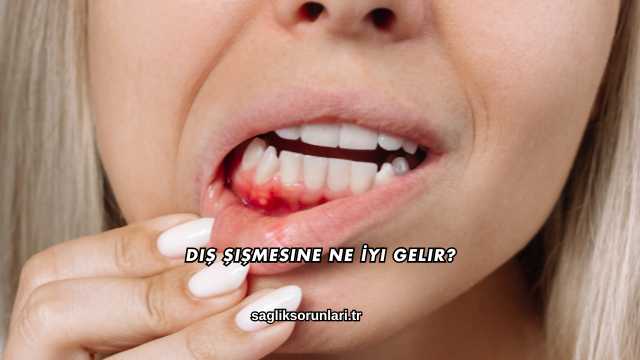 Diş Şişmesine Ne İyi Gelir?