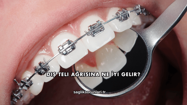 Diş Teli Ağrısına Ne İyi Gelir?