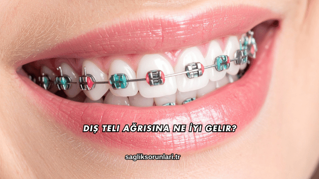 Diş Teli Ağrısına Ne İyi Gelir?