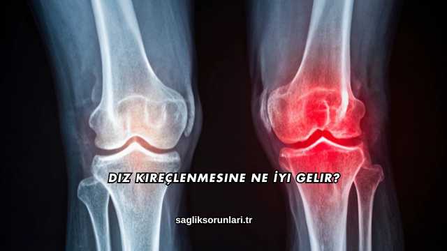 Diz Kireçlenmesine Ne İyi Gelir?