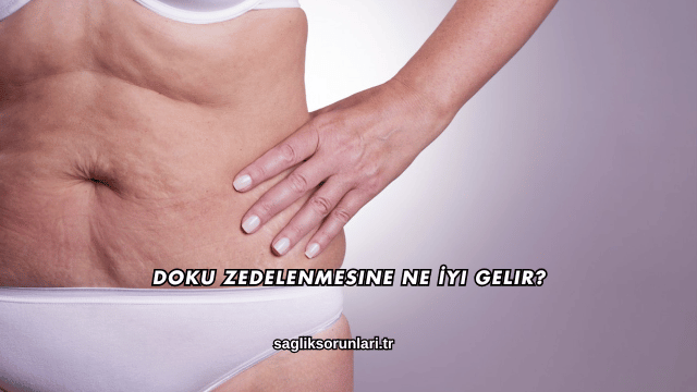 Doku Zedelenmesine Ne İyi Gelir?