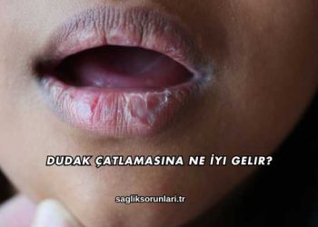 Dudak Çatlamasına Ne İyi Gelir?