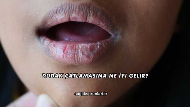 Dudak Çatlamasına Ne İyi Gelir?