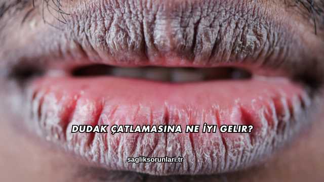 Dudak Çatlamasına Ne İyi Gelir?