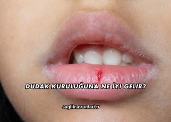 Dudak Kuruluğuna Ne İyi Gelir?
