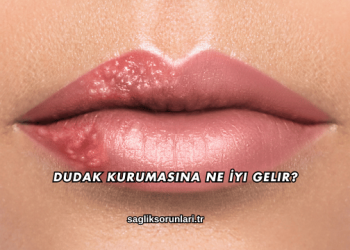 Dudak Kurumasına Ne İyi Gelir?