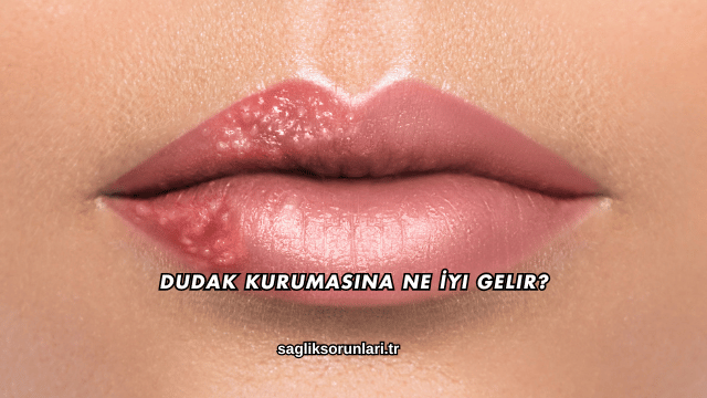 Dudak Kurumasına Ne İyi Gelir?