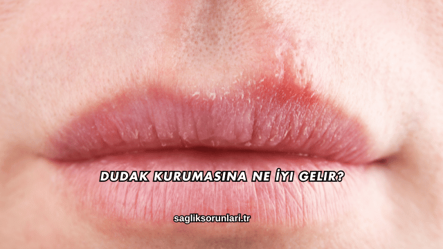 Dudak Kurumasına Ne İyi Gelir?