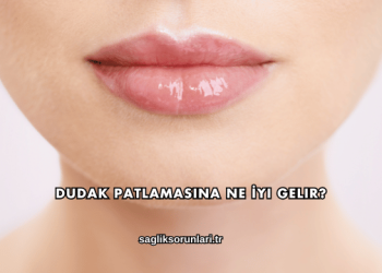 Dudak Patlamasına Ne İyi Gelir?