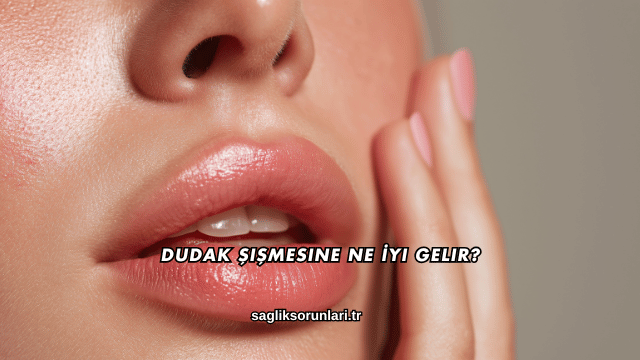 Dudak Şişmesine Ne İyi Gelir?