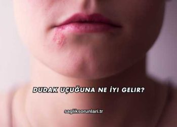 Dudak Uçuğuna Ne İyi Gelir?