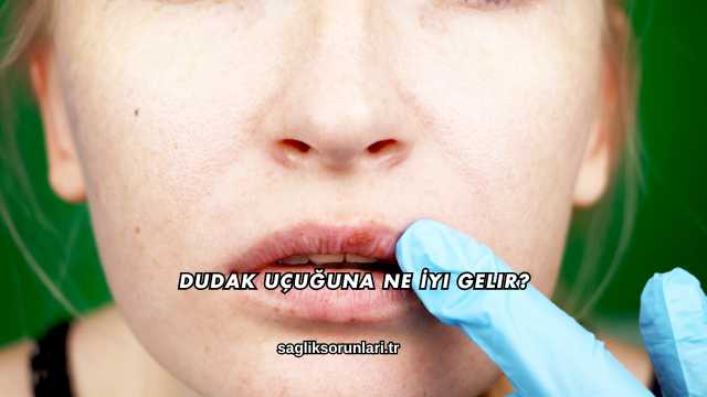 Dudak Uçuğuna Ne İyi Gelir?