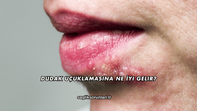 Dudak Uçuklamasına Ne İyi Gelir?