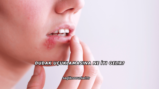 Dudak Uçuklamasına Ne İyi Gelir?