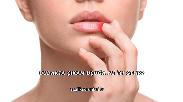 Dudakta Çıkan Uçuğa Ne İyi Gelir?