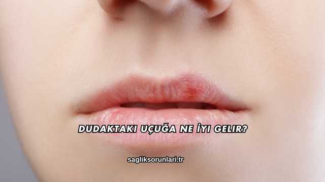 Dudaktaki Uçuğa Ne İyi Gelir?