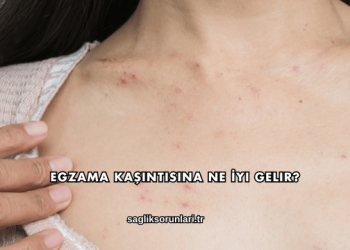 Egzama Kaşıntısına Ne İyi Gelir?
