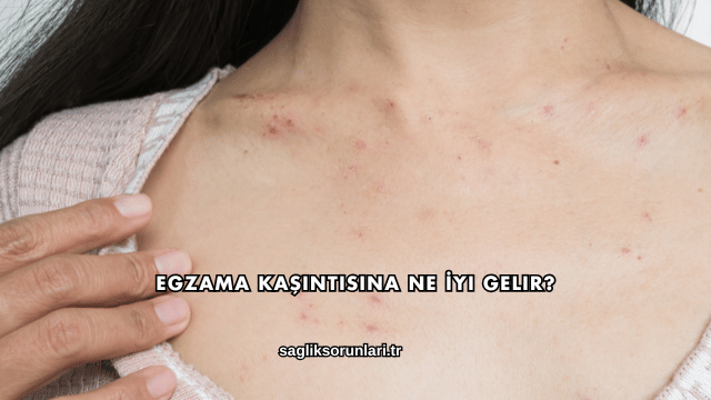 Egzama Kaşıntısına Ne İyi Gelir?