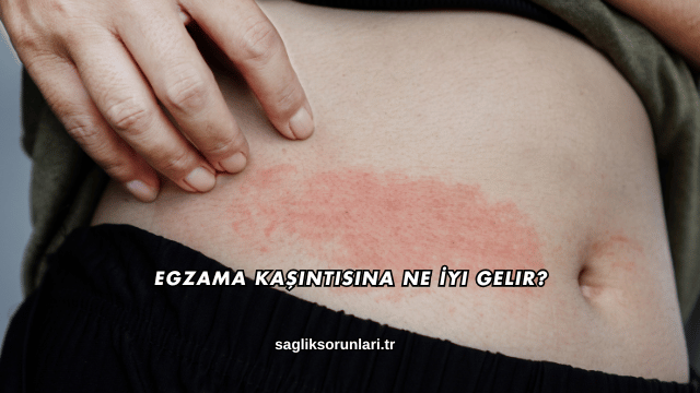 Egzama Kaşıntısına Ne İyi Gelir?