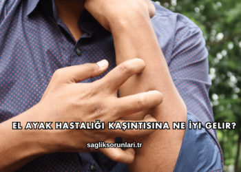 El Ayak Hastalığı Kaşıntısına Ne İyi Gelir?