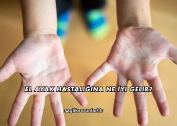 El Ayak Hastalığına Ne İyi Gelir?