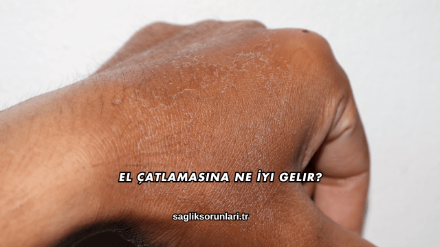 El Çatlamasına Ne İyi Gelir?