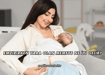Emzirirken Yara Olan Memeye Ne İyi Gelir?