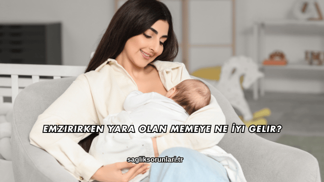 Emzirirken Yara Olan Memeye Ne İyi Gelir?